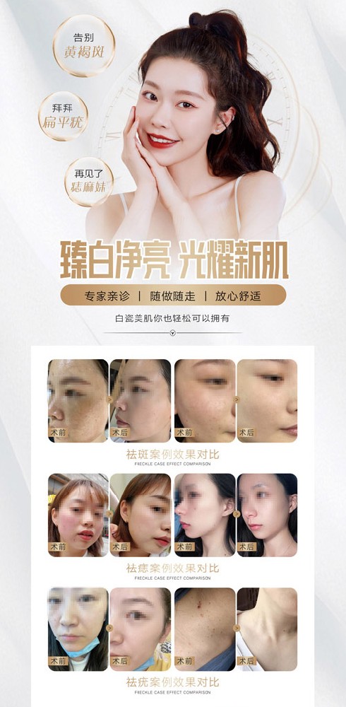 欢乐塑减肥合作收费标准